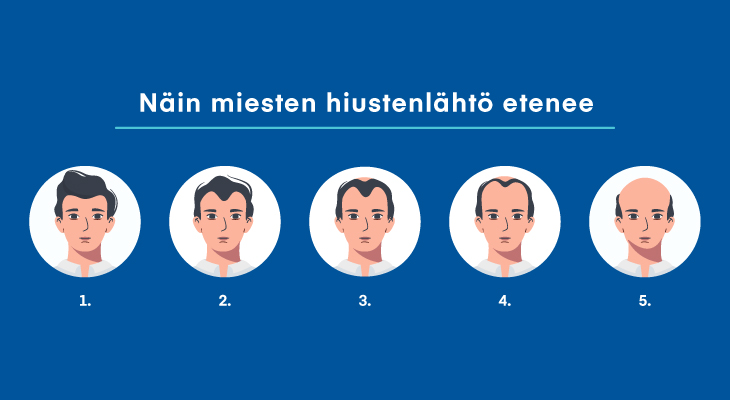 IHA_Androgeeninen_hiustenlahto_730x400.jpg