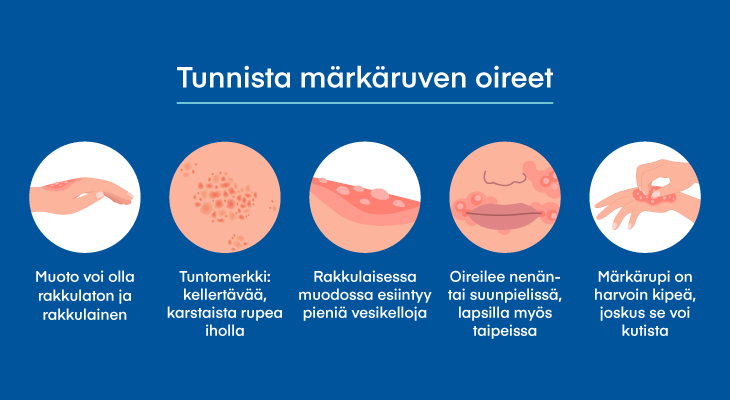 IHA_markarupi_infografiikka_730x400.jpg